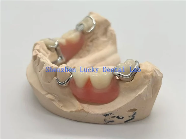 پاره ای اکریلیک با قلاب های فلزی ریخته گری