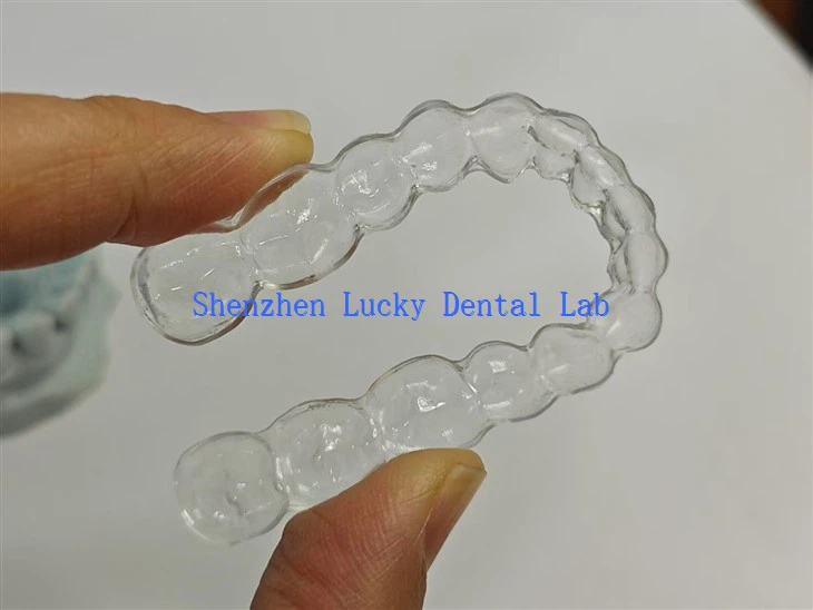 Clear Wire Retainers